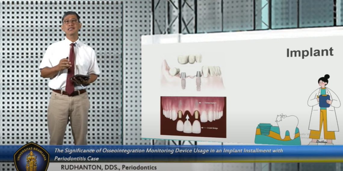 BSMD FKG UB Dorong Kemajuan Teknologi Kedokteran Gigi